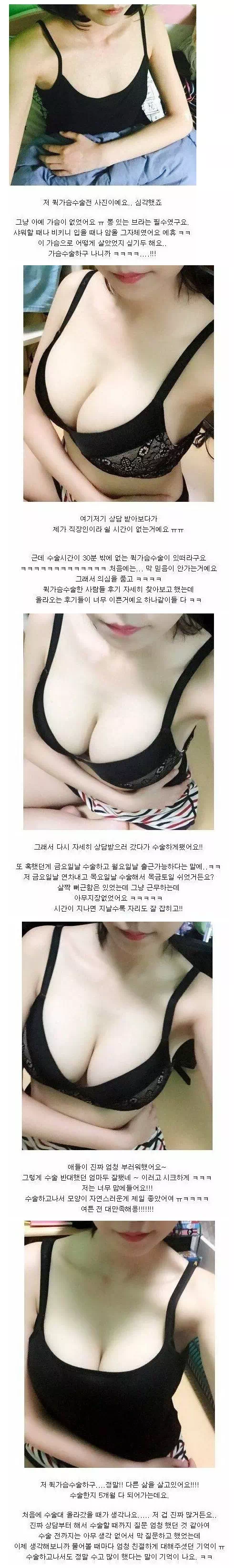 여자들이 가슴 수술하는 이유
