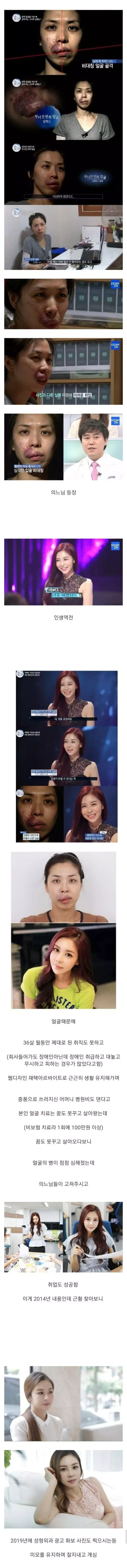 렛미인